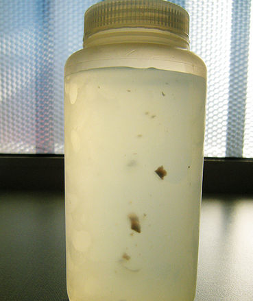 Biofilm Wasser.jpg