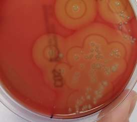 Hier hat sich der Staphylococcus aureus auf einer Agrarplatte im Labor vermehrt.