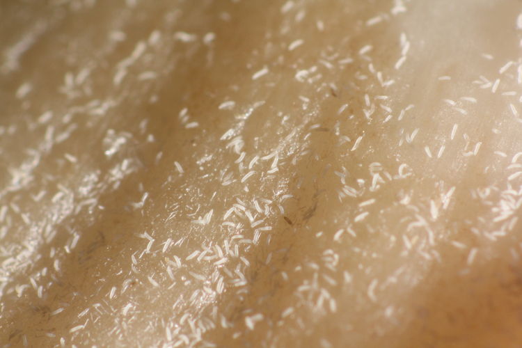 Massenhafter Befall durch die Knoblauchgallmilbe.jpg © Anna Moyses/AGES Massenhafter Befall durch die Knoblauchgallmilbe.jpg © Anna Moyses/AGES